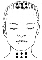 points d'acupuncture tenseurs du visage