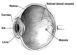 dégénérescence maculaire de l'oeil