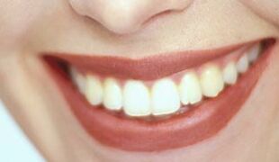 sourire et dents blanches