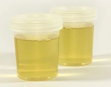 test d'urine