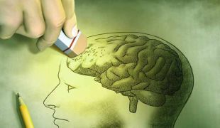 cerveau qui perd la memoire