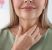 glande thyroide chez une femme